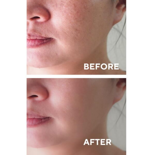 The Ceel Facial Peeling Serum - Image 3